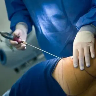 Cosmetic Surgery Referral and Consultation - Metphi Clinic Partner Hospitals