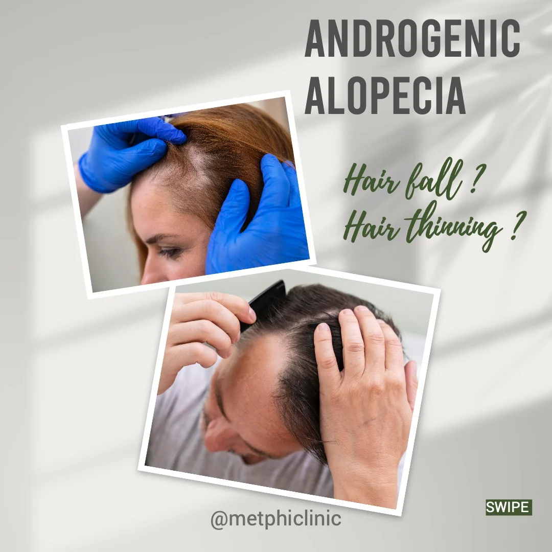 Hair Loss Treatment Result at Metphi Clinic