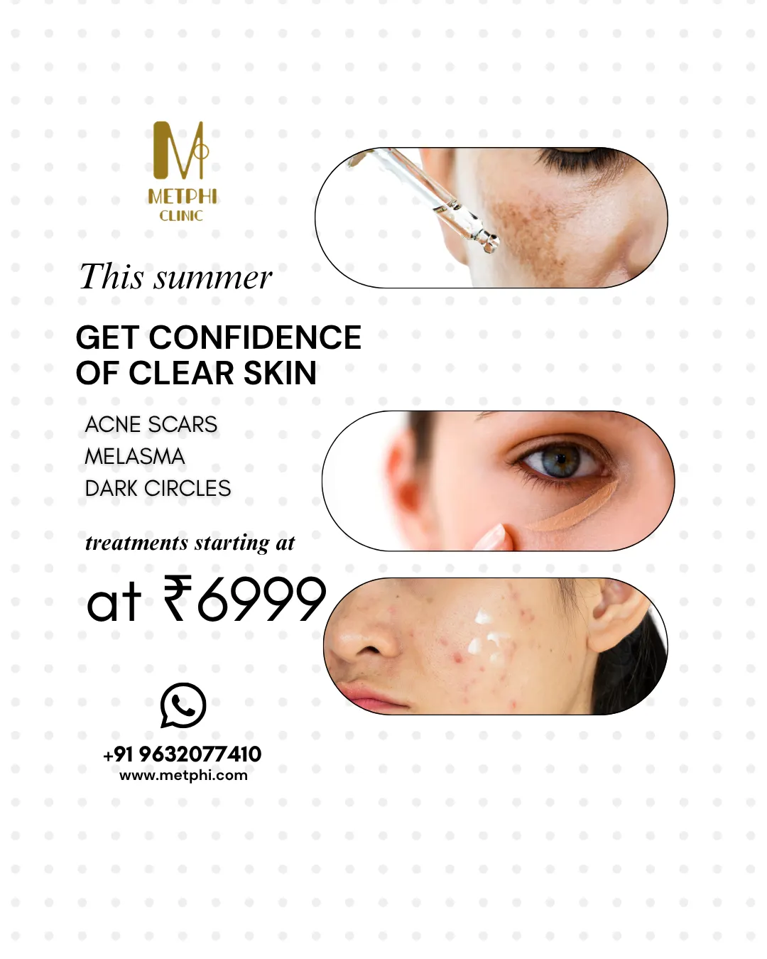 acne-treatment-offer