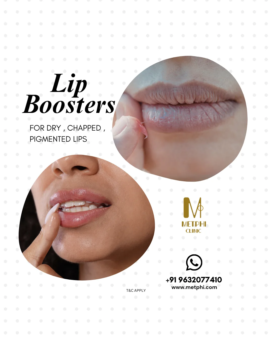 lip-booster-offer